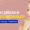 get rid of Dark Spots and Freckles